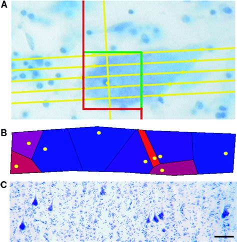 Stereologic characterization and spatial distribution .